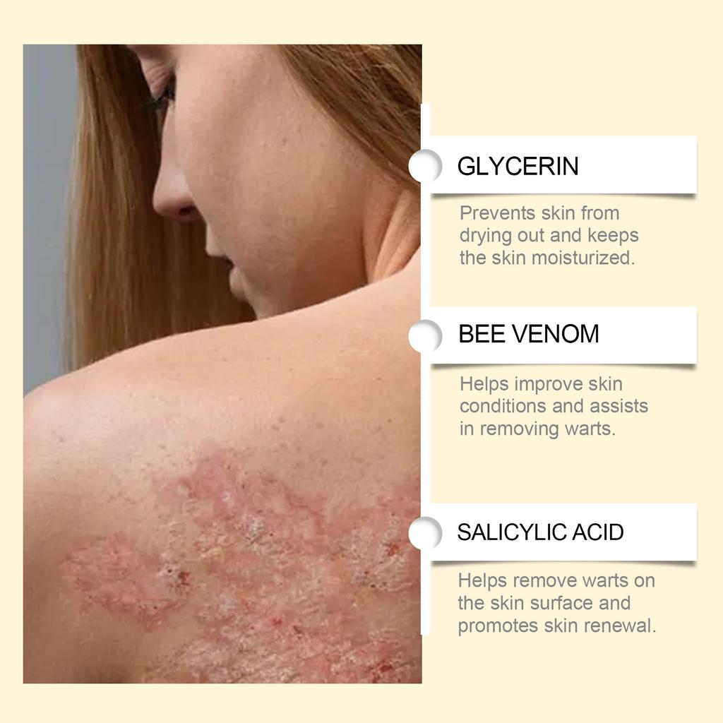 Bee Venom Cream Relieves Redness Repair Damage Skin Strengthens Skin Barrier Deep Moisturizing Skin Care Nourishing Body Cream