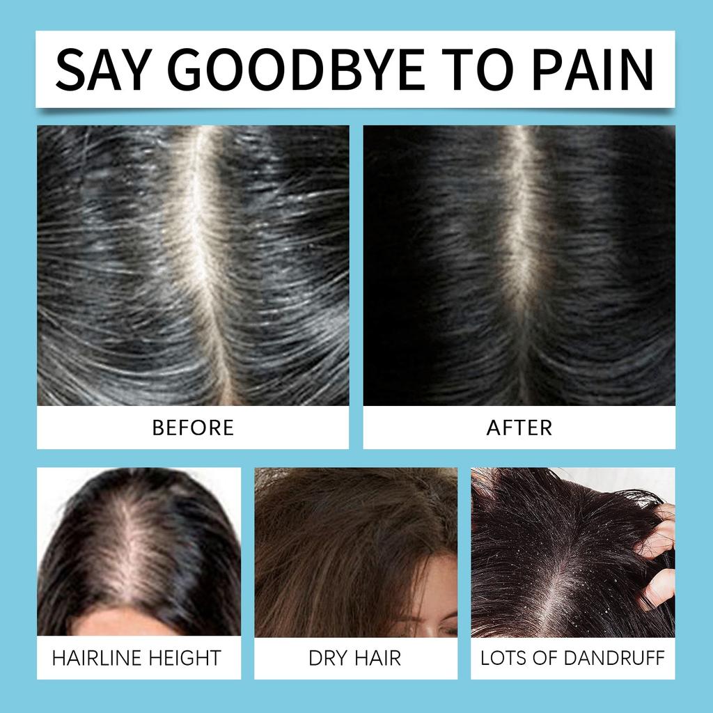 Anti-hair Loss Shampoo Gently Clean Balance Oil Does Not Stimulate Moisture Scalp Strong Hair Dense Nourishment Promote Hair Dense Growth
