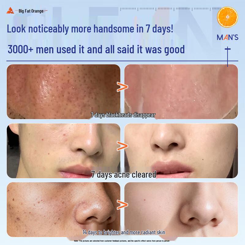 BAILUHUI Citrus VC Mousse Cleanser