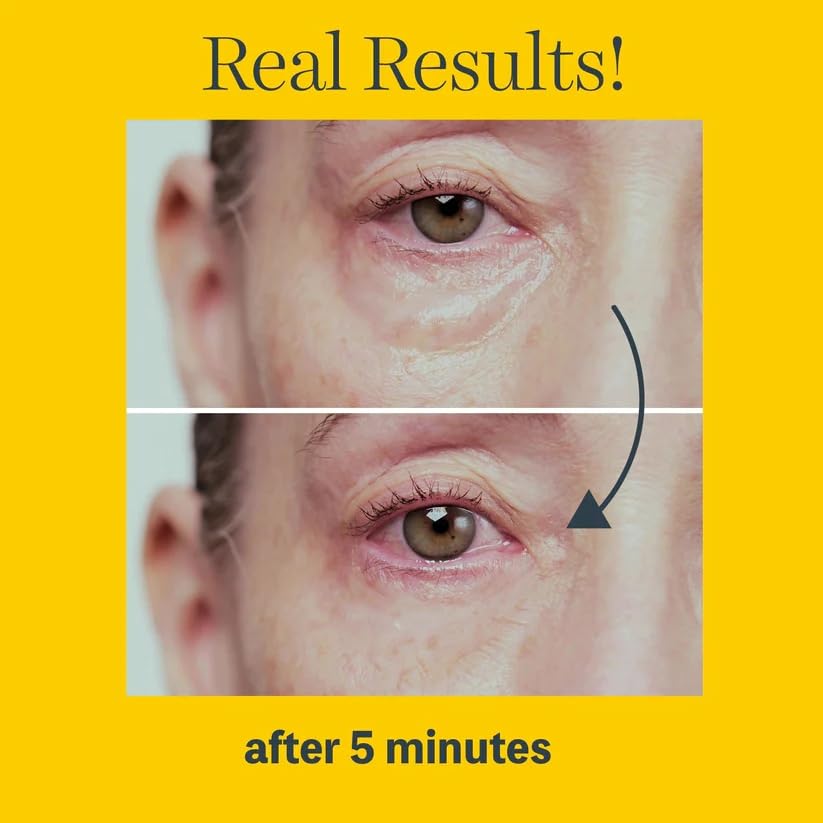 STV TL Hyper Lift Eye Instant Eye Firms and Improves StriVectin Eye Body Miracle Cream, Fix, 10ml, Under-Eye Bags, Anti-Aging Gel,