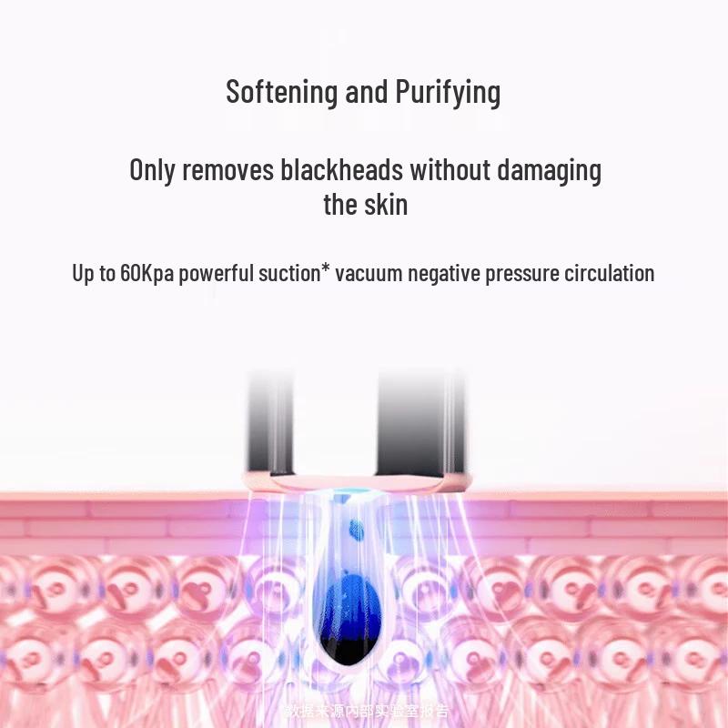 FOREO KIWI Smart Vacuum Blackhead Remover CN plug (adapter included)