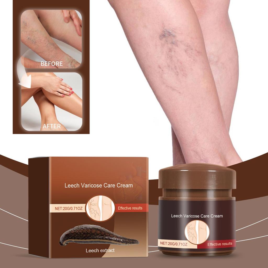 Leech Varicose Care Cream;Varicose Vein Cream For Legs;Varicose Veins MiracleCream