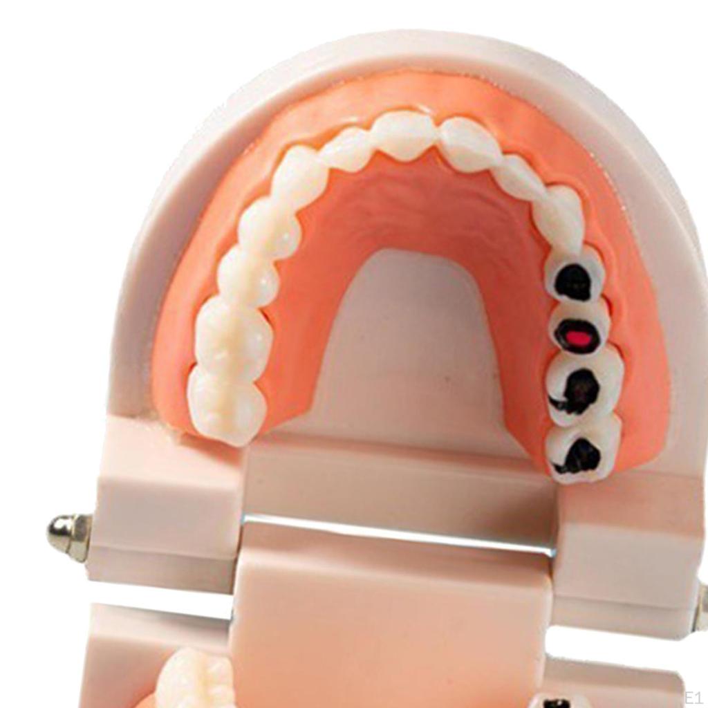 Sumulation Decay Teeth Model Study Teaching for Kids Teacher