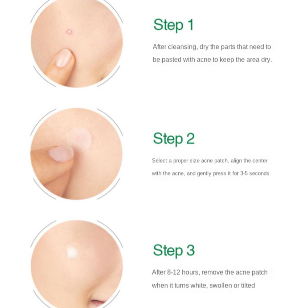 Haut Akne Entfernungspflaster Unsichtbare Schönheitsaufkleber Pickelpflaster Absorbierend Flüssig Transparentes Akne-Reinigungspflaster Hautpflege-Werkzeuge