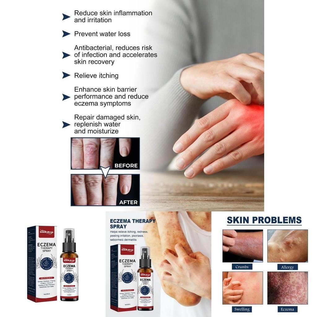 South Moon Skin Care Spray For Relief Of Itchy Skin And Eczema Symptoms In 30ml Bottle