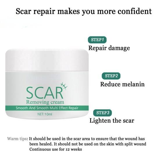 Natürliche Extrakt-Pflanzen-Akne-Stretch-Narben-Entfernungscremes für Sie