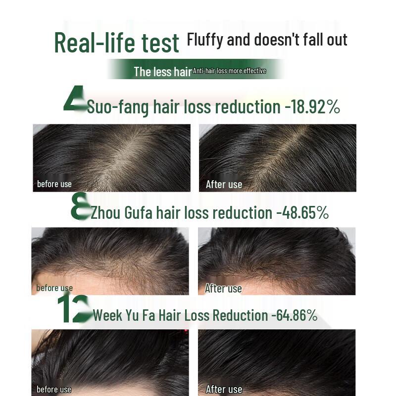 Hexin Anti-Hair Loss Hair Growth Shampoo