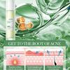 Salicylic Acid Nourishing Essence Milk SADOER Moisturizing Hydrating Refreshing Water Milk