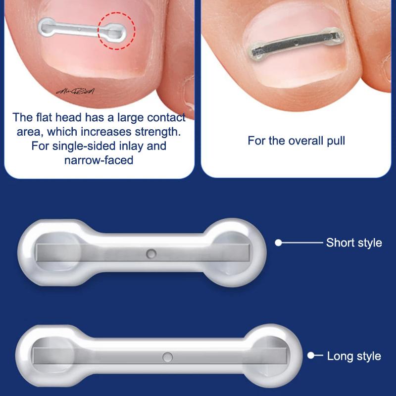 12/10Pcs Ingrown Toenail Treatment Kit Multi-Sized Titanium Alloy Nail Corrector Tools for Curved Toenails