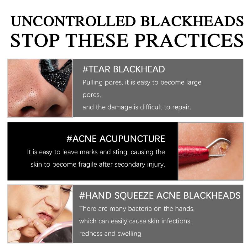 Deep Cleansing Blackhead Mask with Oil Control for Acne and Pore Minimizing
