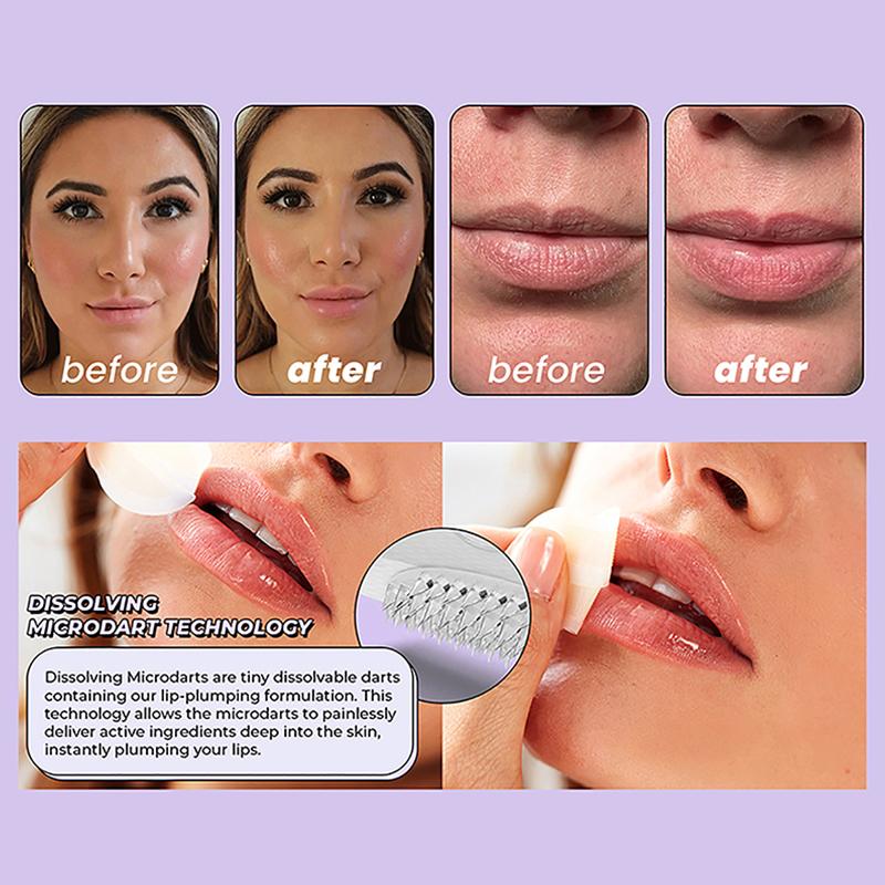 1 Pair Hyaluronic Acid Microneedle Lip Patches For Anti Wrinkle Smoothing Mouth Smile Lift Firm Lips Plump Lips Skin Care Patch