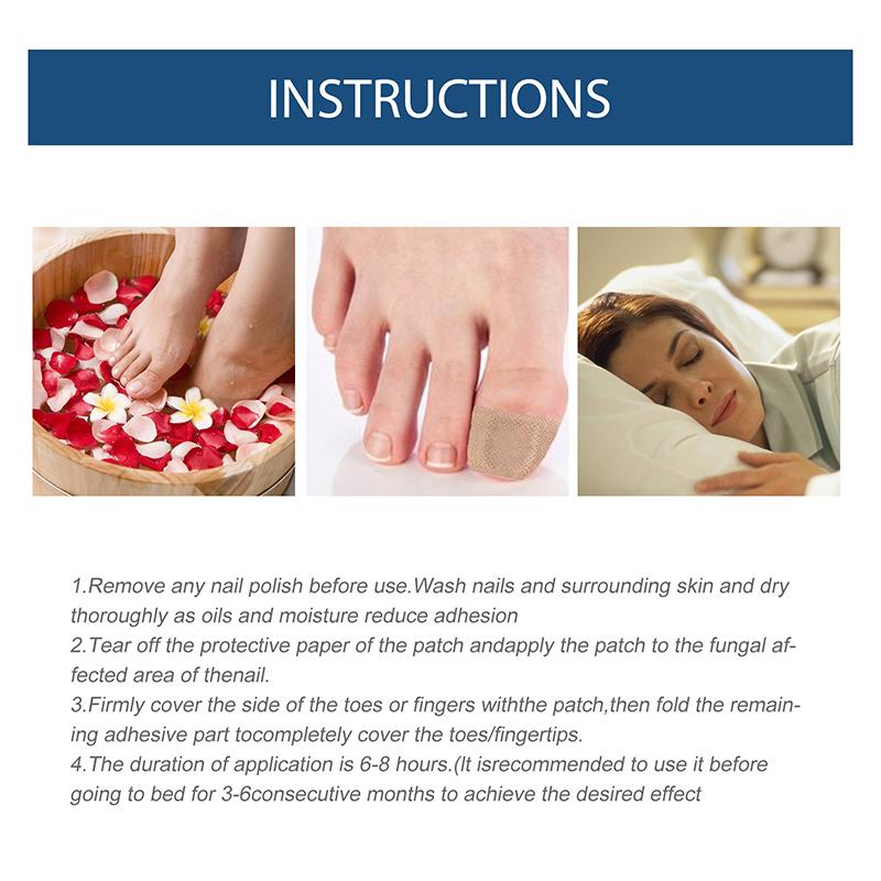 32Pcs  Safe Toenail Correction Patch Nail Repair Straightening Tool Sticker