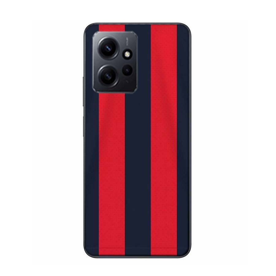 Milan Stylish Stripe Design Phone Case For Redmi Note 14 15 Pro 5G 13 12 Pro Plus 11 11T 11E 11S 10 Pro 10S 9 9S Cover Cell Clea