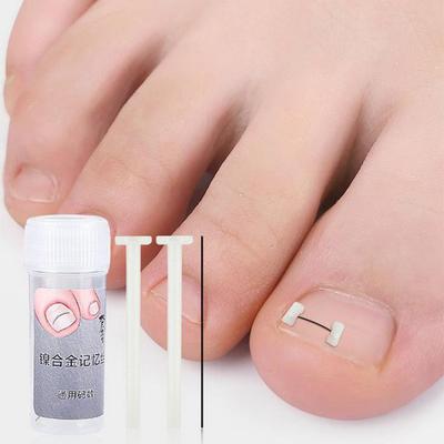 Ingrown Toenail Corrector Tools Pedicure Recover Embed Toe Nail Treatment Professional Ingrown Toenail Correction Foot Care