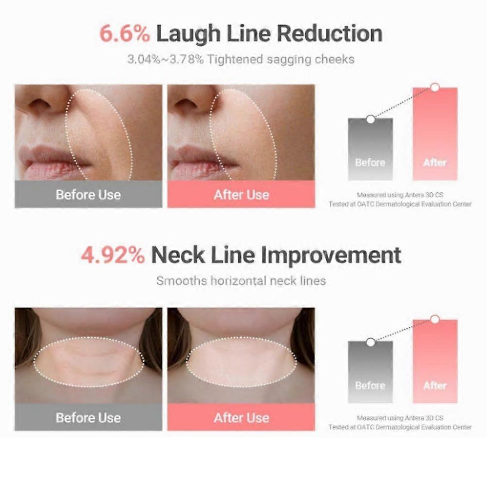 1-3x 2026 New Wrinkle Bounce Multi Balm Stick 9g