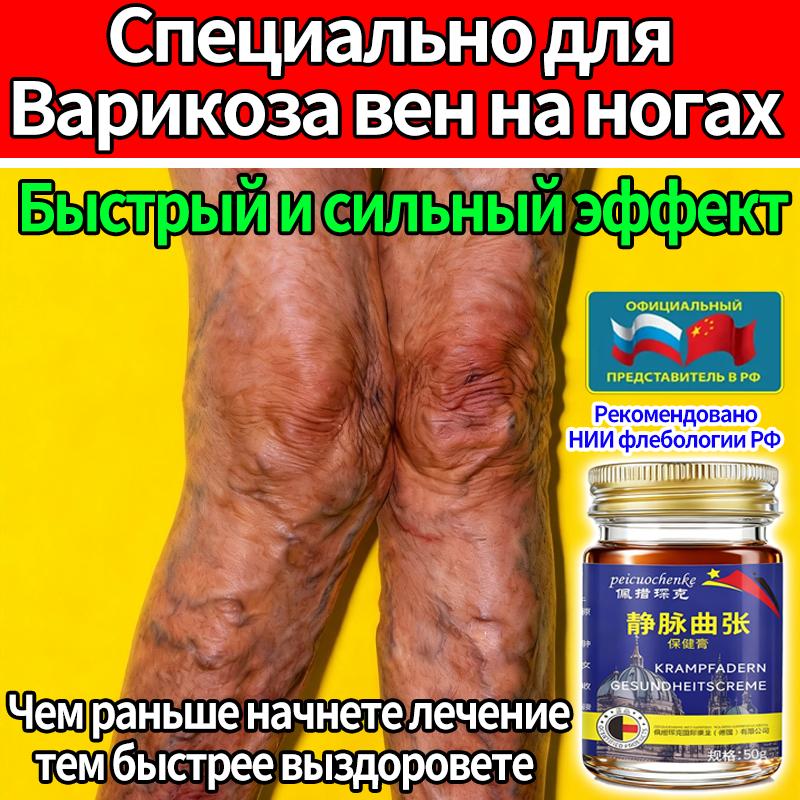 

Мазь и крем от варикозного расширения вен на ногах!