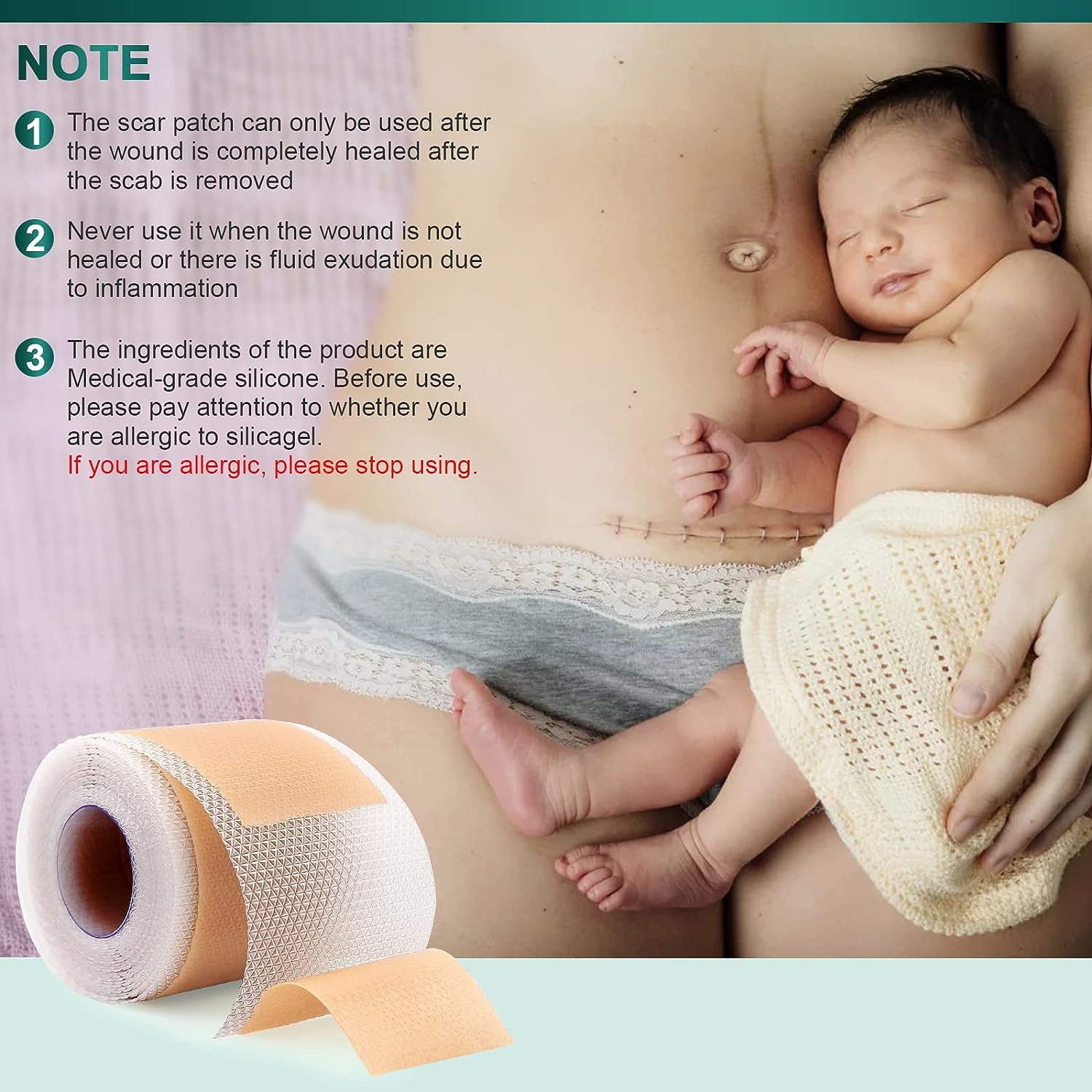 1 шт. 150 см силиконовый гелевый пластырь для лечения шрамов лента для удаления акне — фото 6