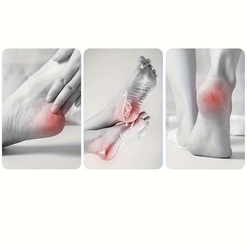 Stainless Steel Foot File - Remover & Anti-Splash Scrub, for Home Spa, Pedicure, Manicure & Nail Care, Pedicure Tools for Feet, Pedicure Essentials