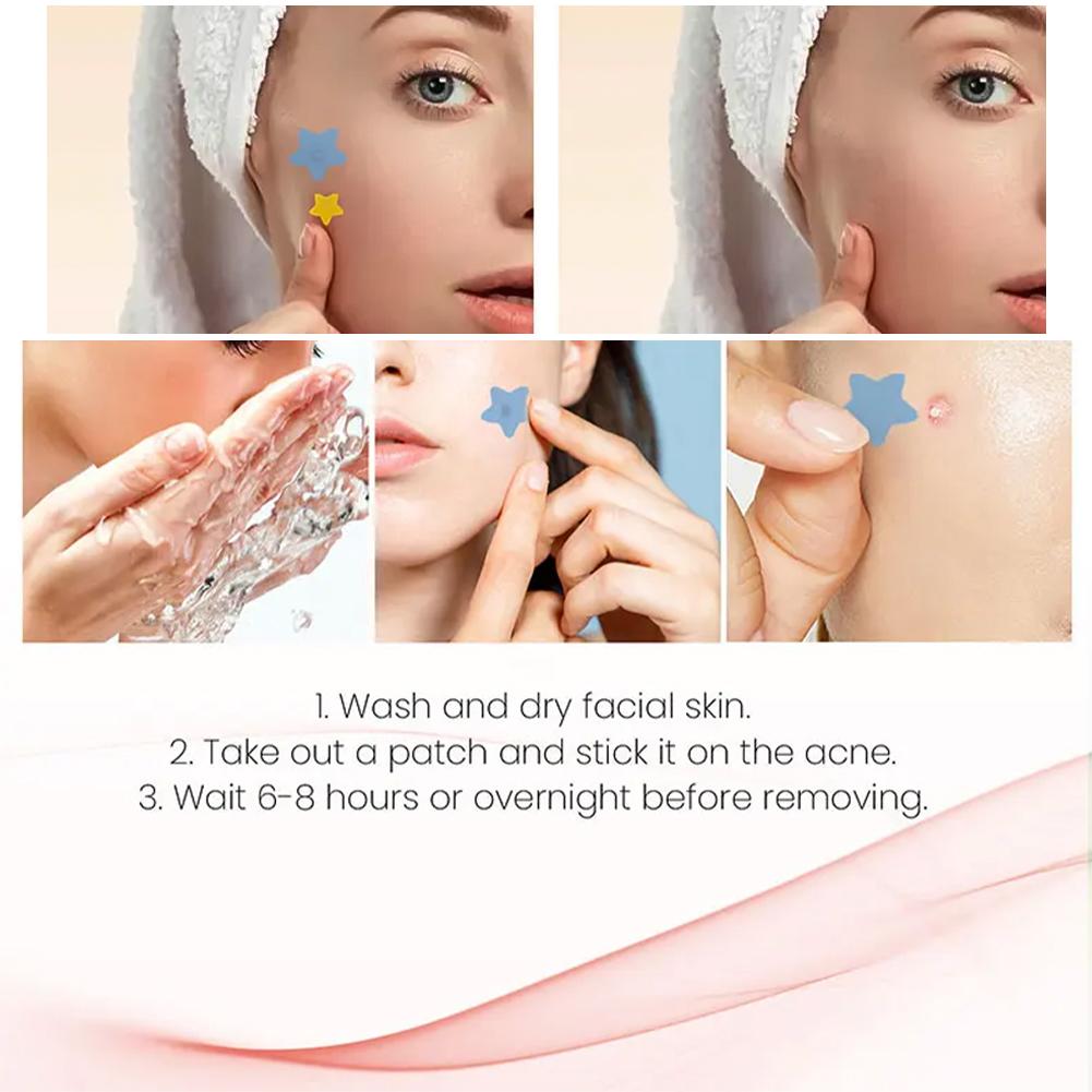 200Pcs Acne Patches Fade Blemishes Pimple Marks Closed Acne Blemishes Hydrocolloid Star Heart Shaped Cover Acne Pimple Patch