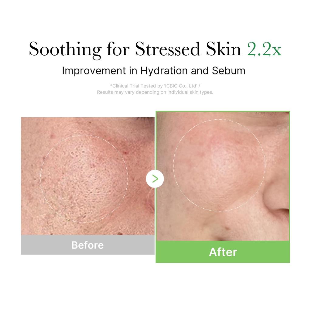 Medicube Exosome Cica Cream, Moisturizing, Moisture Barrier, Hydrating, Skincare, Korean Cosmetics, Moisturizing