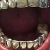 1/2 Pcs Glossy Finish Eco Friendly Copper Top Bottom Teeth Grillz Set Anti Slip Silver Gold Teeth Jewelry Cosplay