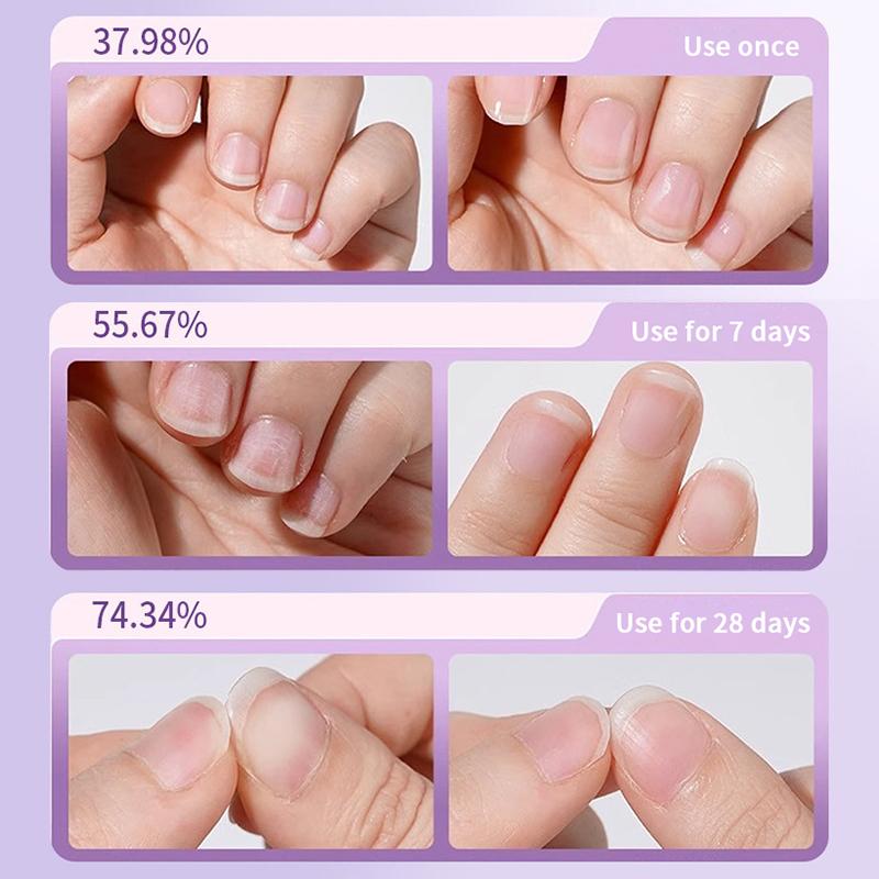 Dikenli Tırnak Kütikül Yağı Nemlendirici Besleyici Tırnak Kütikül Giderici Kalem Parlatıcı Tırnak Bakım Esansı Kalemi Hasarlı Tırnaklar İçin