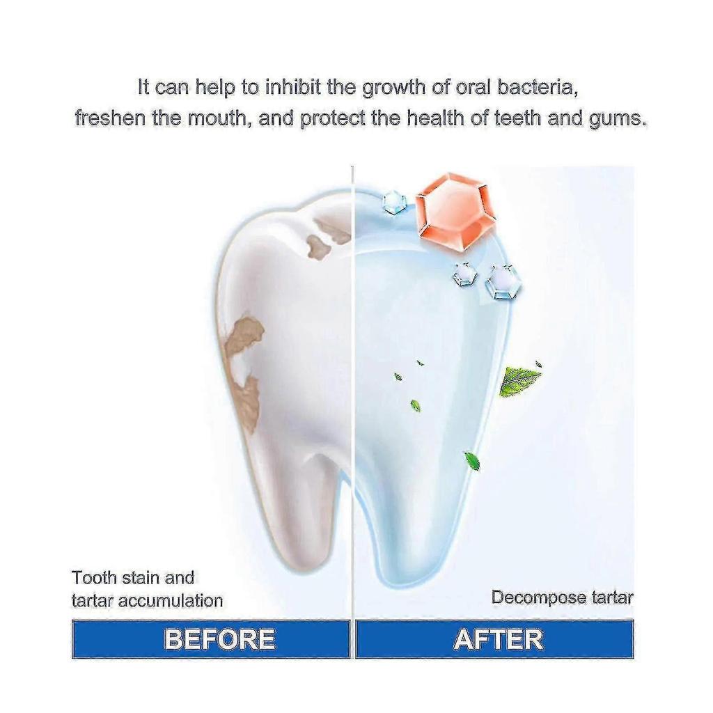 OUHOE Teeth Whitening Essence Teeth Cleaning Care Removes Dental Plaque Smoke Stains Bad Breath Oral