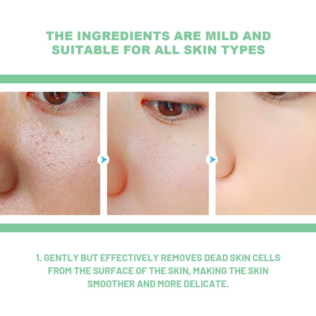 Face Exfoliating Cream Dead Spot Remover Moisturizing Face Scrub Whitening Exfoliating Pores Brightening Exfoliator Peeling Gel