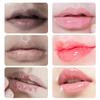 15g Remove Dark Lip Balm Lip Essence Cream Lighten Lip Lines Whitening Moisturizing Brightening Serum Lip Care Product Women Men
