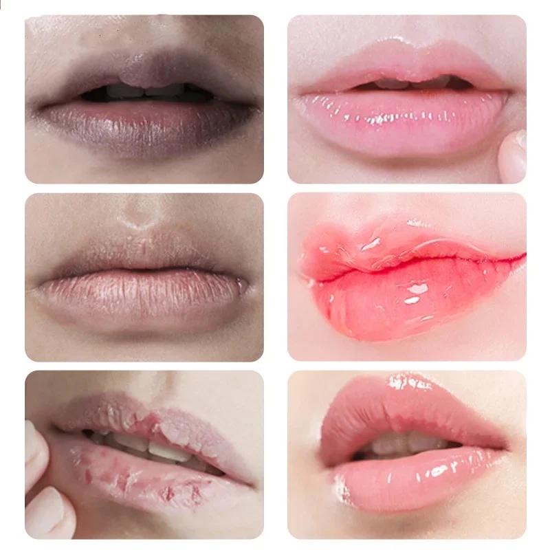 15g Remove Dark Lip Balm Lip Essence Cream Lighten Lip Lines Whitening Moisturizing Brightening Serum Lip Care Product Women Men