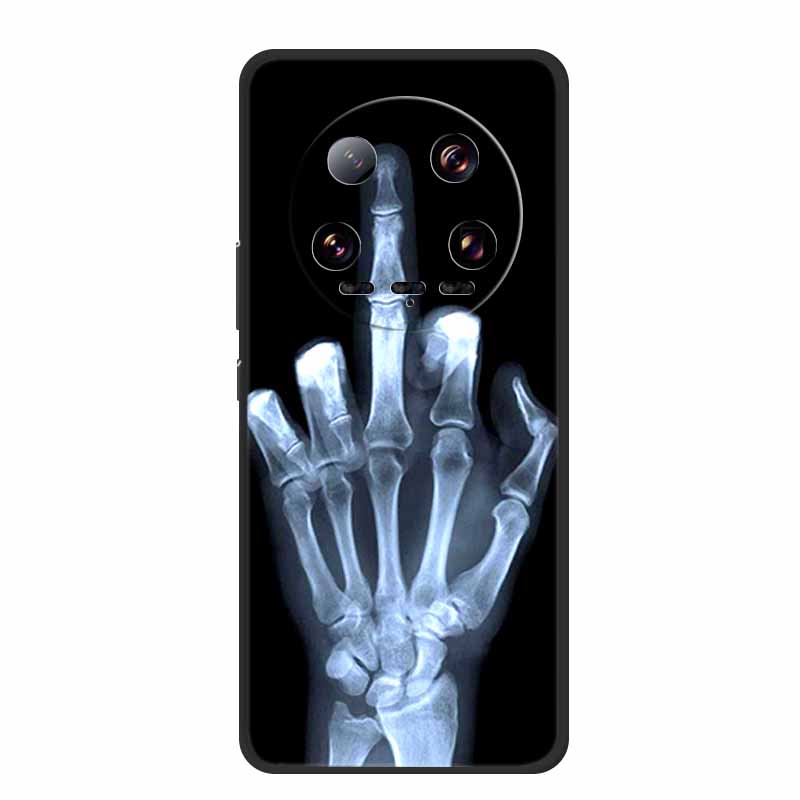 Für Xiaomi 14 Ultra Hülle Tiere TPU Silikon Weiche Rückabdeckung Handyhüllen für Xiaomi14 Ultra Schutz 24031PN0DC Coole Hülle