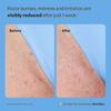 50ml Ingrown Hair Treatment Serum for Bikini Line Underarms and Legs Redness Relief with Natural Plant Extracts Non-Greasy Fast Absorbing Gentle