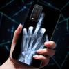 For TCL 205 Cases Fashion Silicone Soft TPU Protective Covers for TCL205 Phone Cases Floral Fundas for TCL 205 4187D 2021 Coque