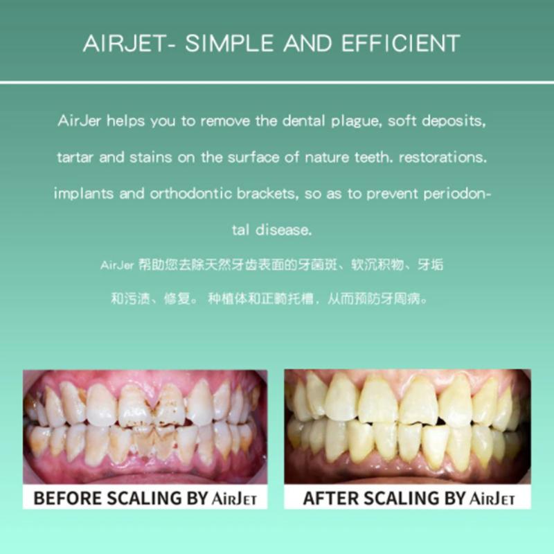 Dental Air Flow Prophy Jet Airjet 1/1S Luftpolierer Sandstrahler Zähne Polieren Handstück Hygiene Prophy Jet Maschine