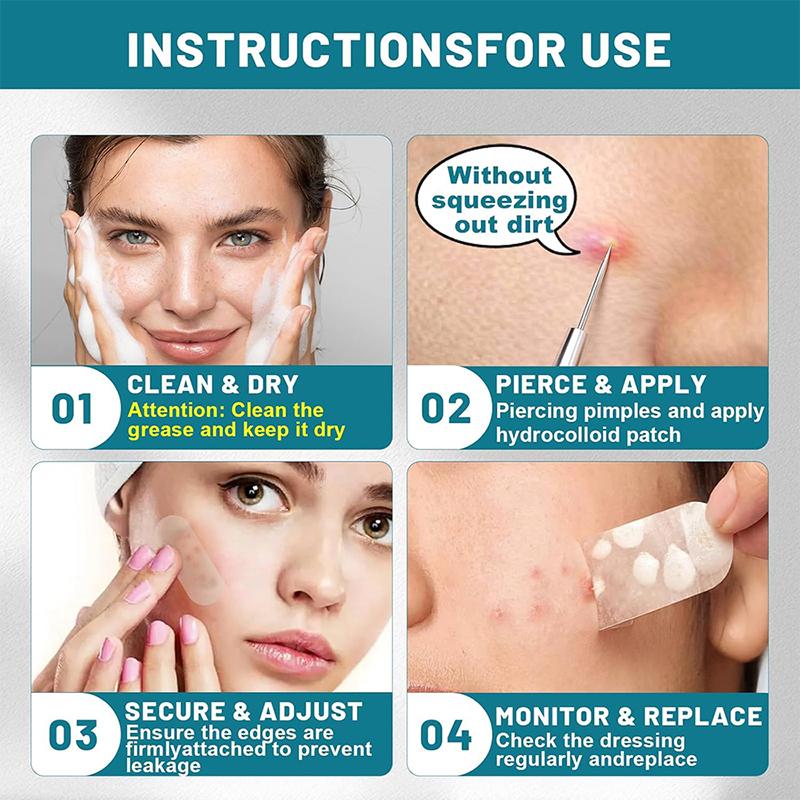 Hydrocolloid Roll For Wound Care Hydrocolloid Patch Bandages With Self-Adhesive, Bed Sore Bandages, Highly Absorbent