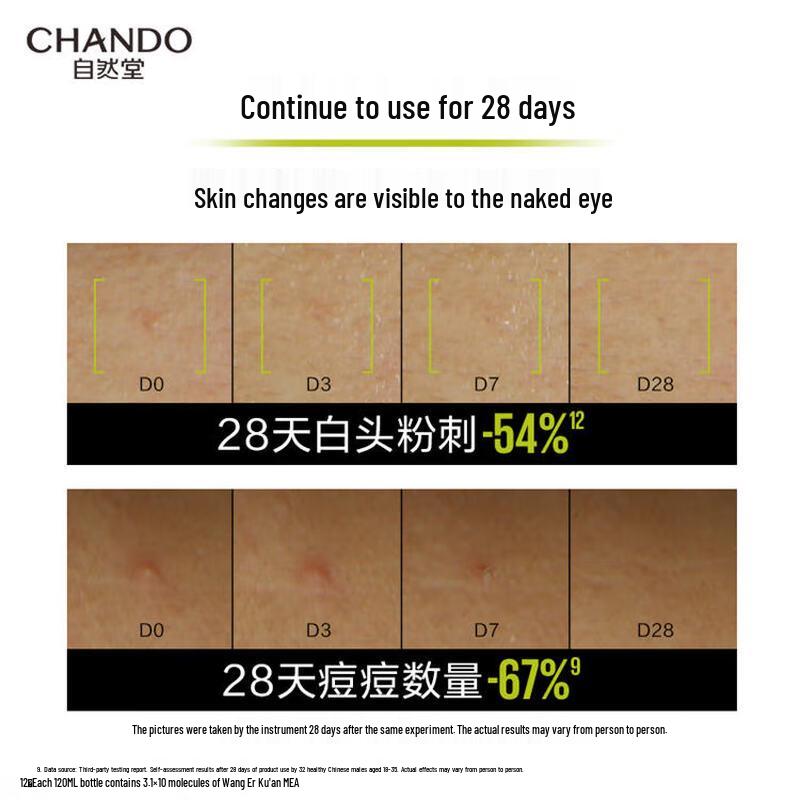 CHANDO Men's Glacial Oil Control Refreshing Lotion
