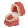 Modello Dimostrativo Ortodontico Dentale Modello di Denti con Fili Metallici e Bracket per Insegnamento