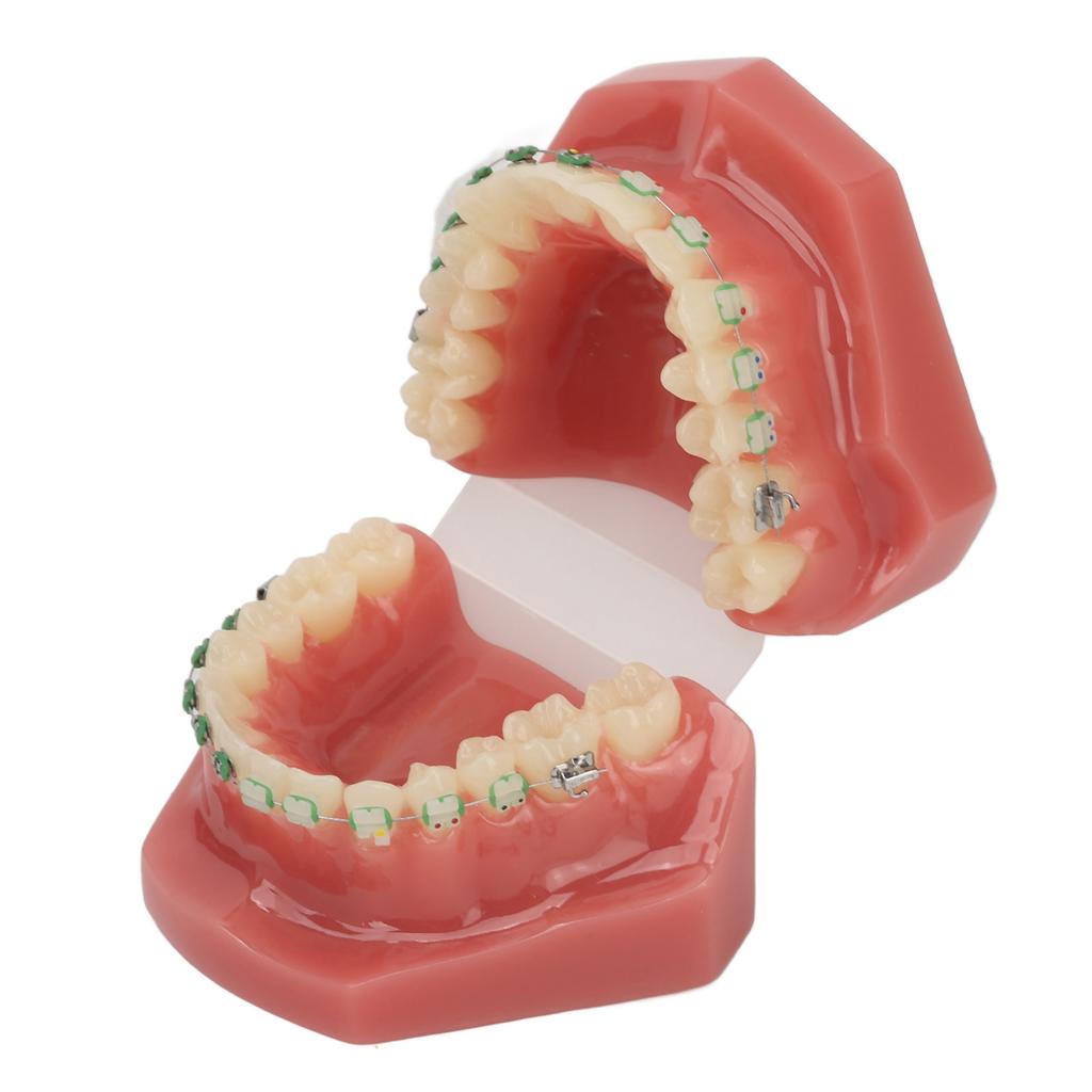 Modello Dimostrativo Ortodontico Dentale Modello di Denti con Fili Metallici e Bracket per Insegnamento