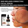 EELHOE Melanin Correcting Serum Fade Dark Spots Anti Freckle Melasma Remover Lightening Pigment Blemish Vitamin C Face Essence