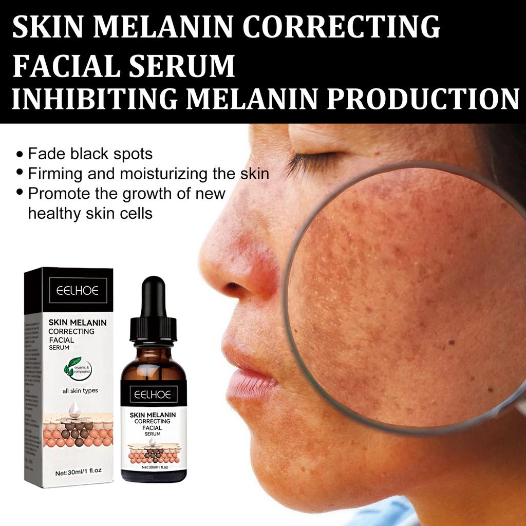 EELHOE Melanin Correcting Serum Fade Dark Spots Anti Freckle Melasma Remover Lightening Pigment Blemish Vitamin C Face Essence