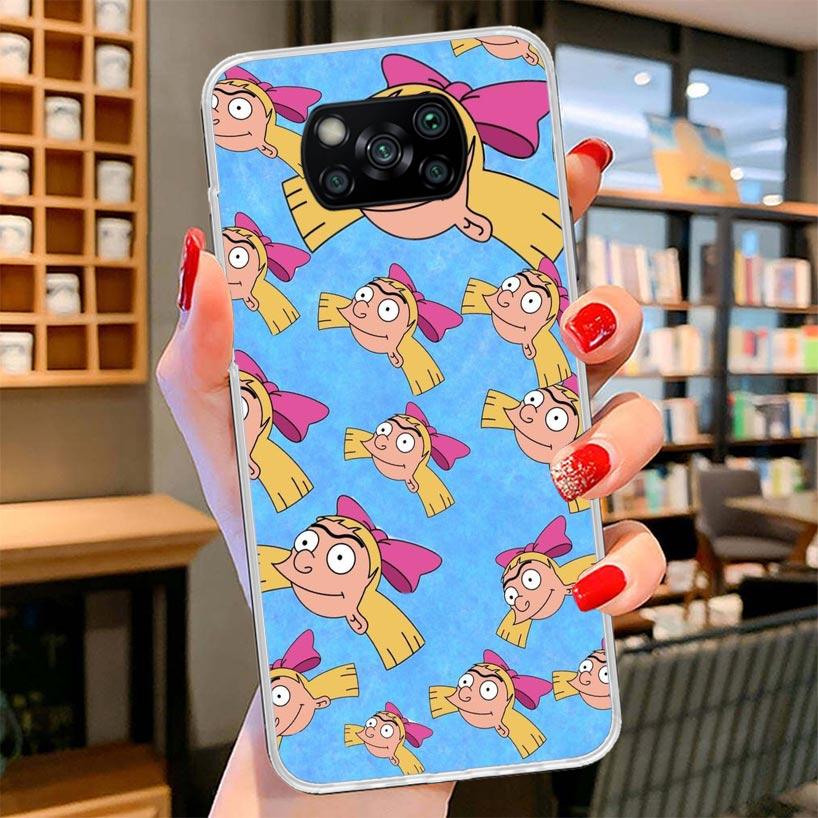 Cartoon Hey Arnold Fondos Cover Phone Case For Xiaomi Poco F7 Ultra X7 X6 X5 Pro M7 Redmi 15C 15 13C 13 12C 12 10C 10 9A 9C 9T 9