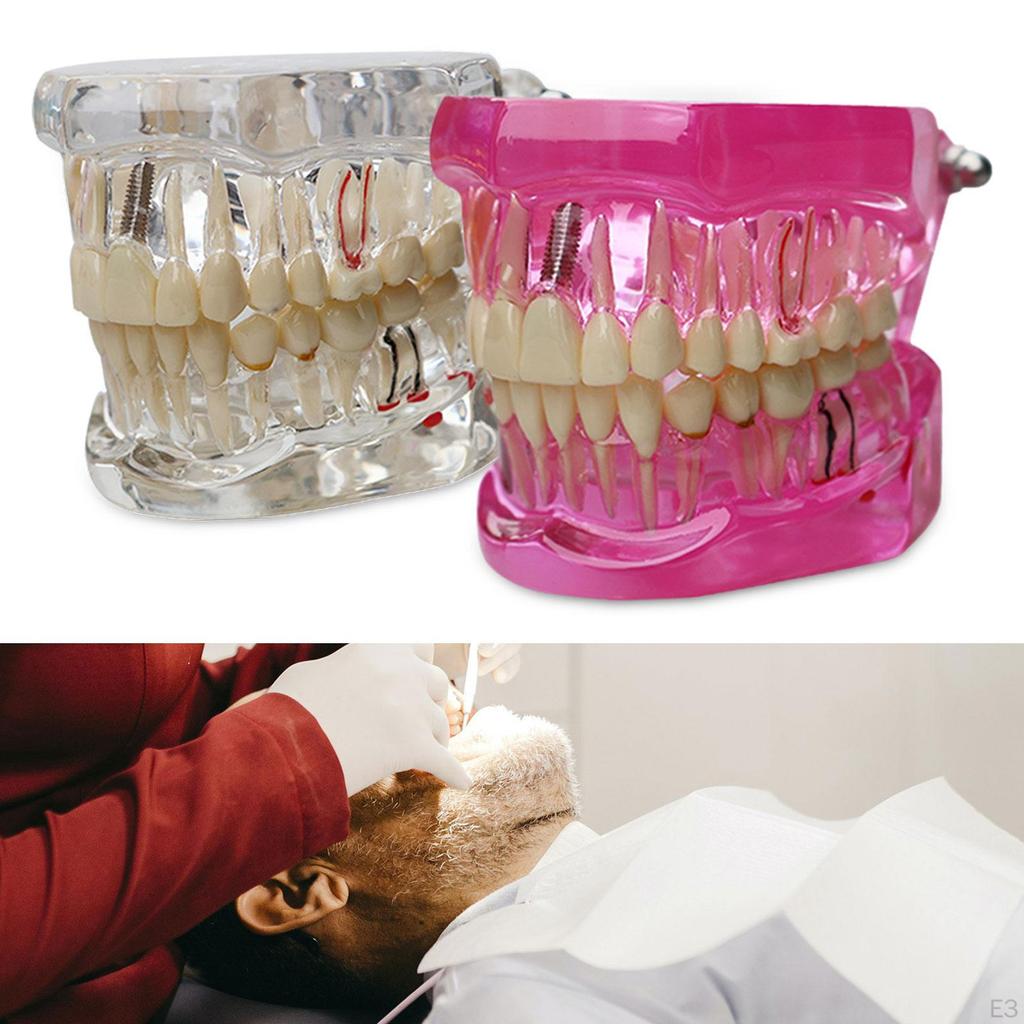 Dental Demonstration Teeth Model Student Education Teaching Aid