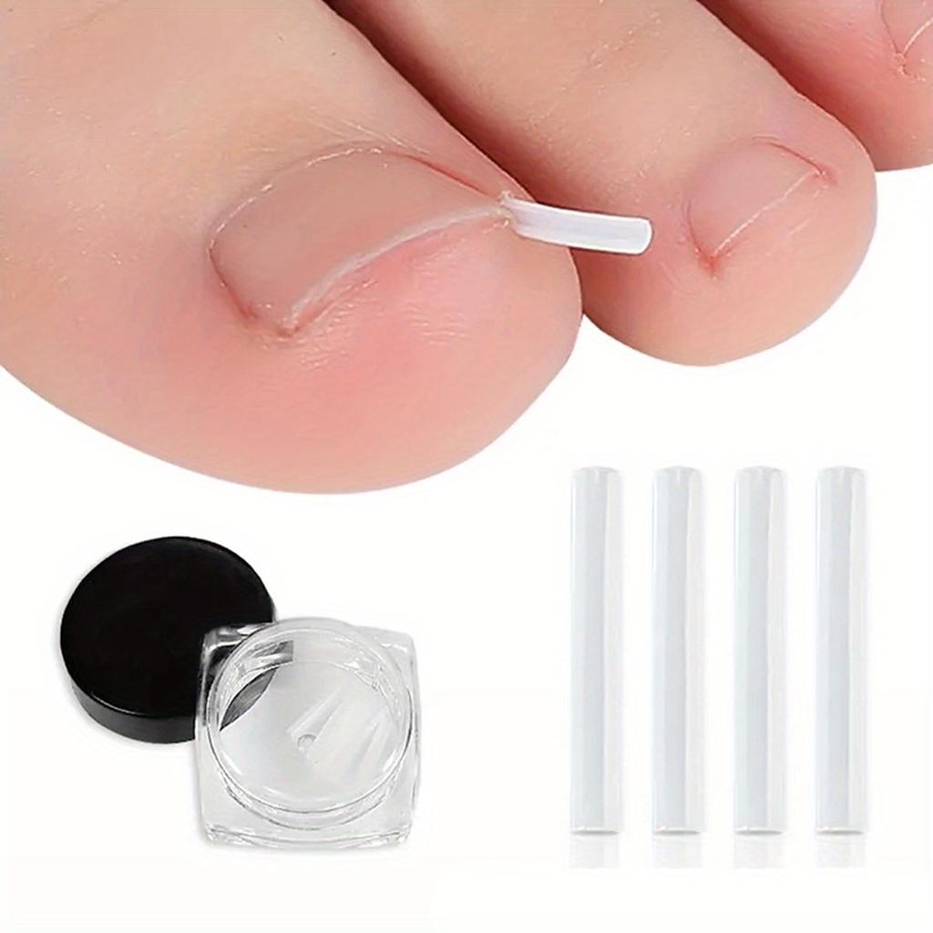 10Pcs Toenail Straightening Clippers Toenail Correction Tools Set Nail Care Elastic Stickers Pedicure Foot Care Tools