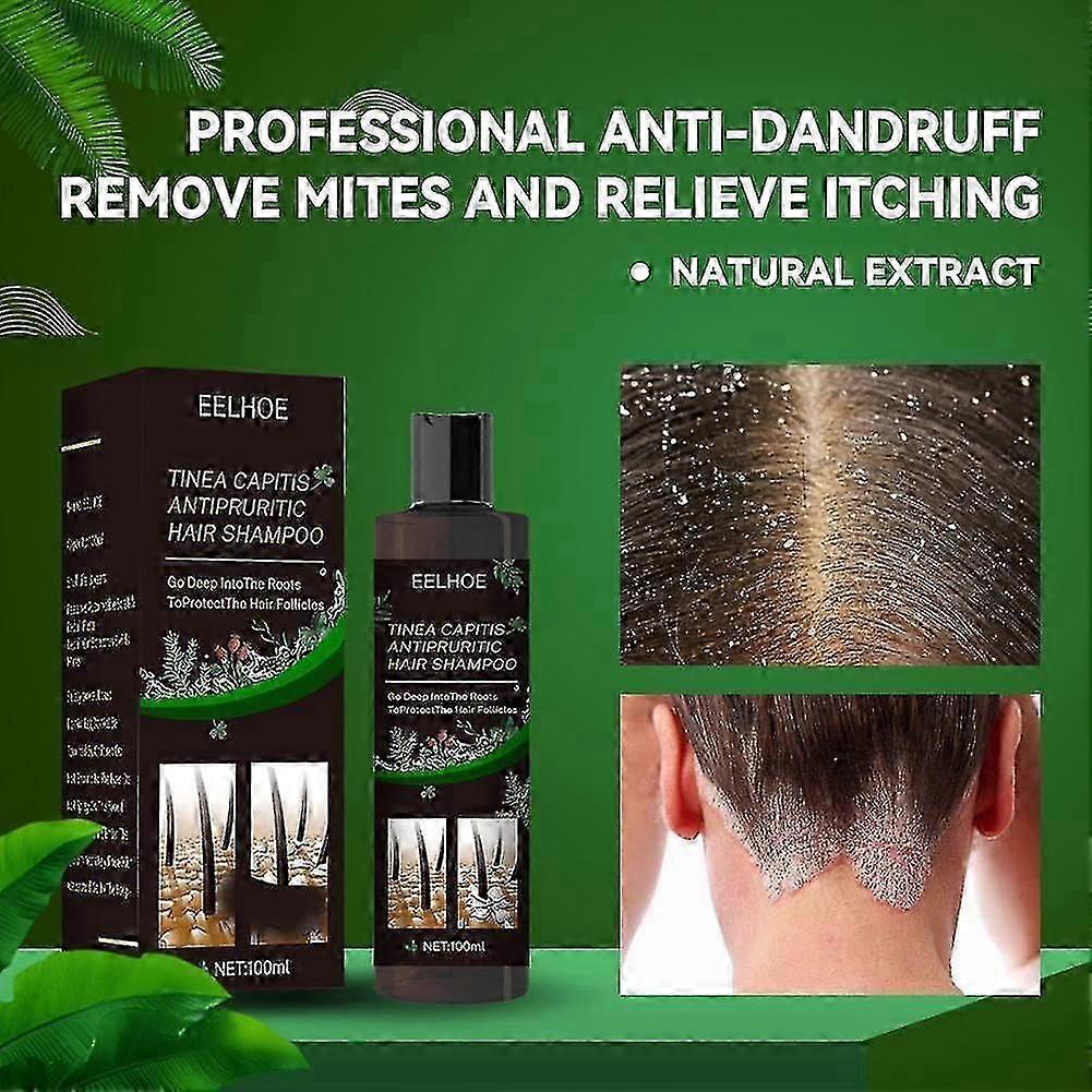 Mild Sulfate-Free Shampoo for Sensitive Scalps with Dermatitis Relief