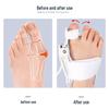 Adjustable Hallux Valgus Corrector for Big Toe Protrusion & Overlapping Toe Separator