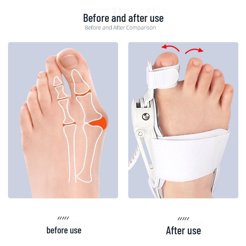 Adjustable Hallux Valgus Corrector for Big Toe Protrusion & Overlapping Toe Separator