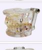 Human Tooth Anatomy Model for Teaching and Simulation - Detachable Denture Mold