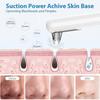 Blackhead Removal Vacuum, Blackhead Removal Tool with 4 Suction Probes, Blackhead Remover for Face, Cordless Pore Vacuum Acne Whitehead Remover, Black
