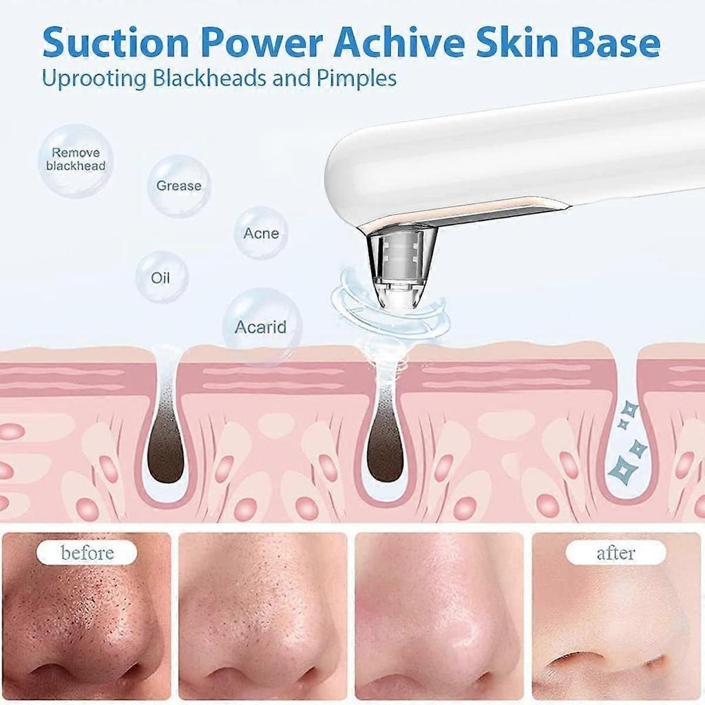 Blackhead Removal Vacuum, Blackhead Removal Tool with 4 Suction Probes, Blackhead Remover for Face, Cordless Pore Vacuum Acne Whitehead Remover, Black
