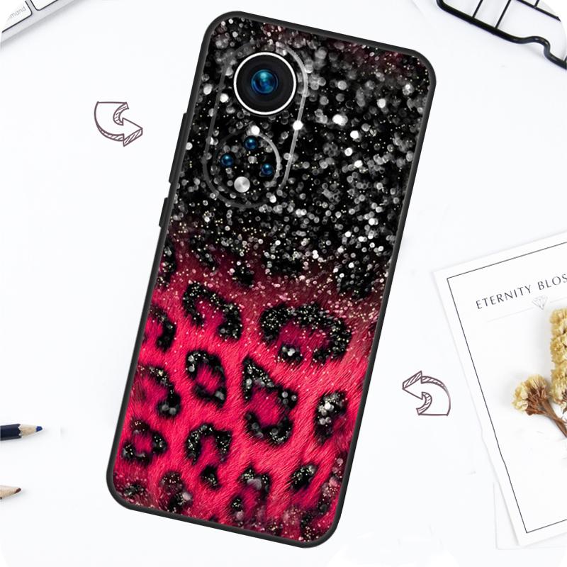 Leopard Print Case For Honor Magic 7 5 6 Lite Honor 200 Pro X8b X9a X8a X8 X9 X9c X9b 50 70 90 Lite Cover